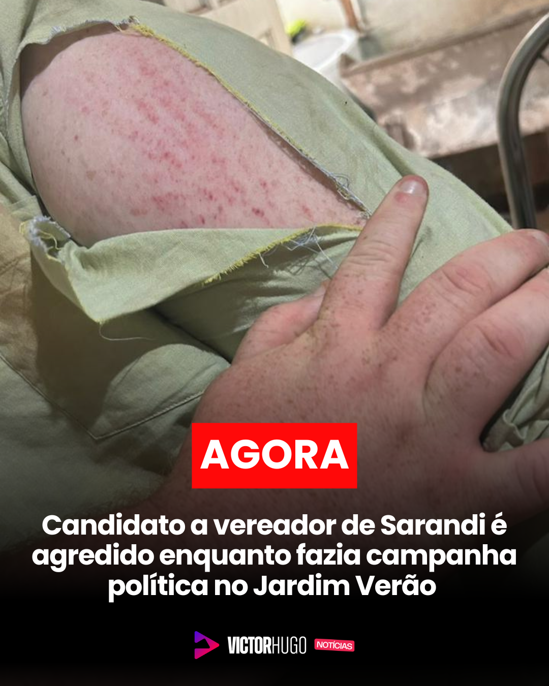 Candidato a vereador de Sarandi é agredido por casal no Jardim Verão